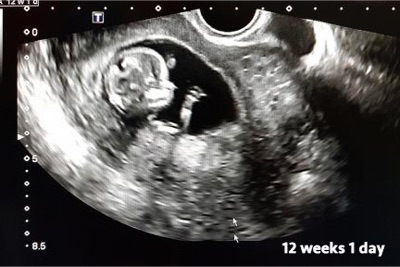 Parsha Ve'eira: The Moral Failure of Plausible Deniability