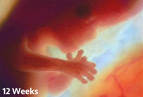 Pro-Life Torah Korach