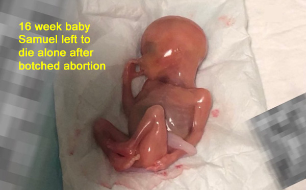 Parshas Yitro: Pro-Life Judaism Offers Hope for the Future