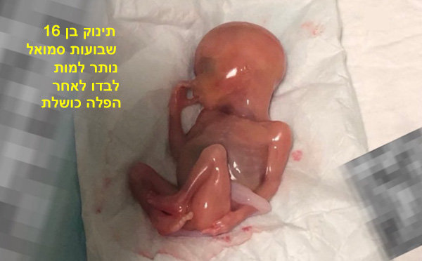 פרשת יתרו: יהדות פרו-לייף מציעה תקווה לעתיד