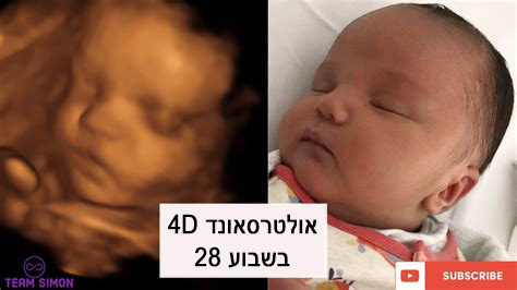 פרשת פנחס: לעצור את מכת ההפלות עכשיו