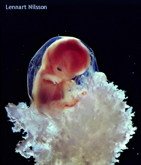 Pro-Life Torah Tazria