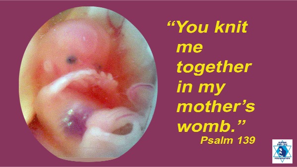 Parshas Vayakhel-Pekudei: Preserving Human Life in the Womb Without Exception