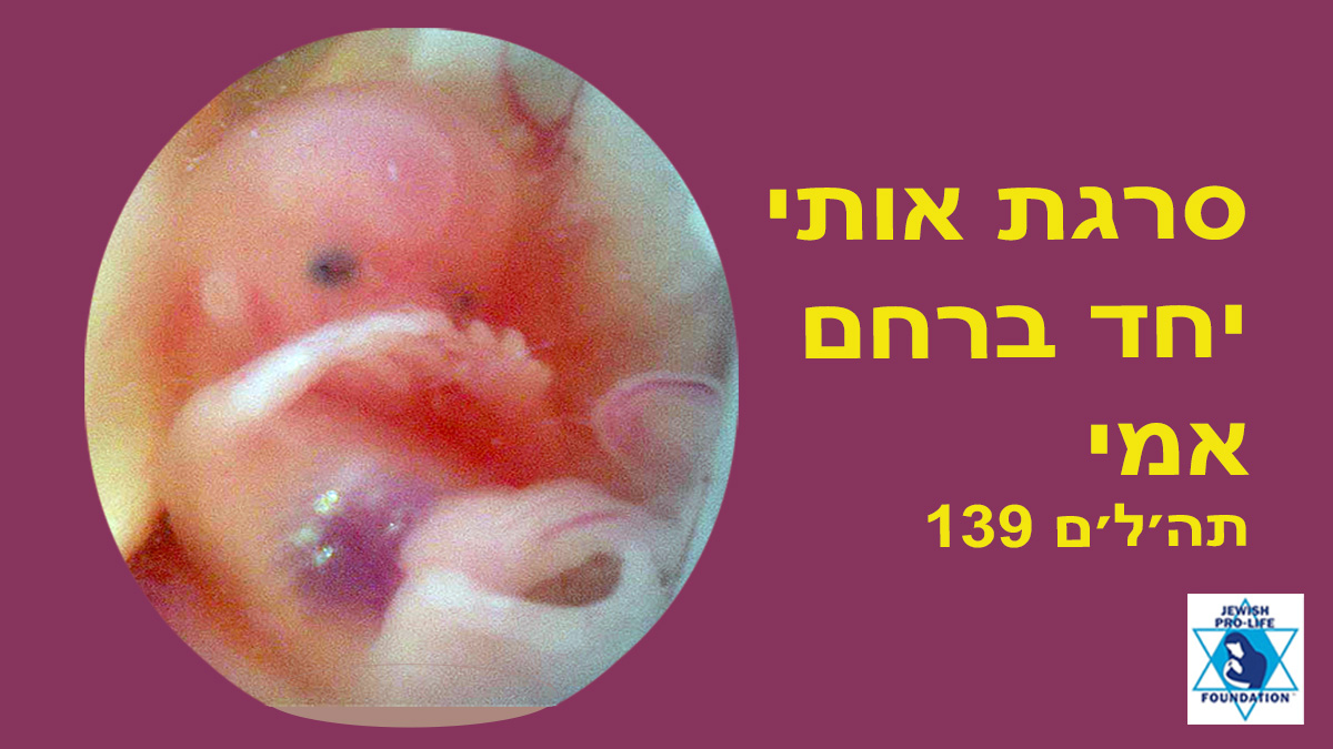 פרשת ויקהל-פקודי: שמירת חיי אדם ברחם ללא יוצא מן הכלל